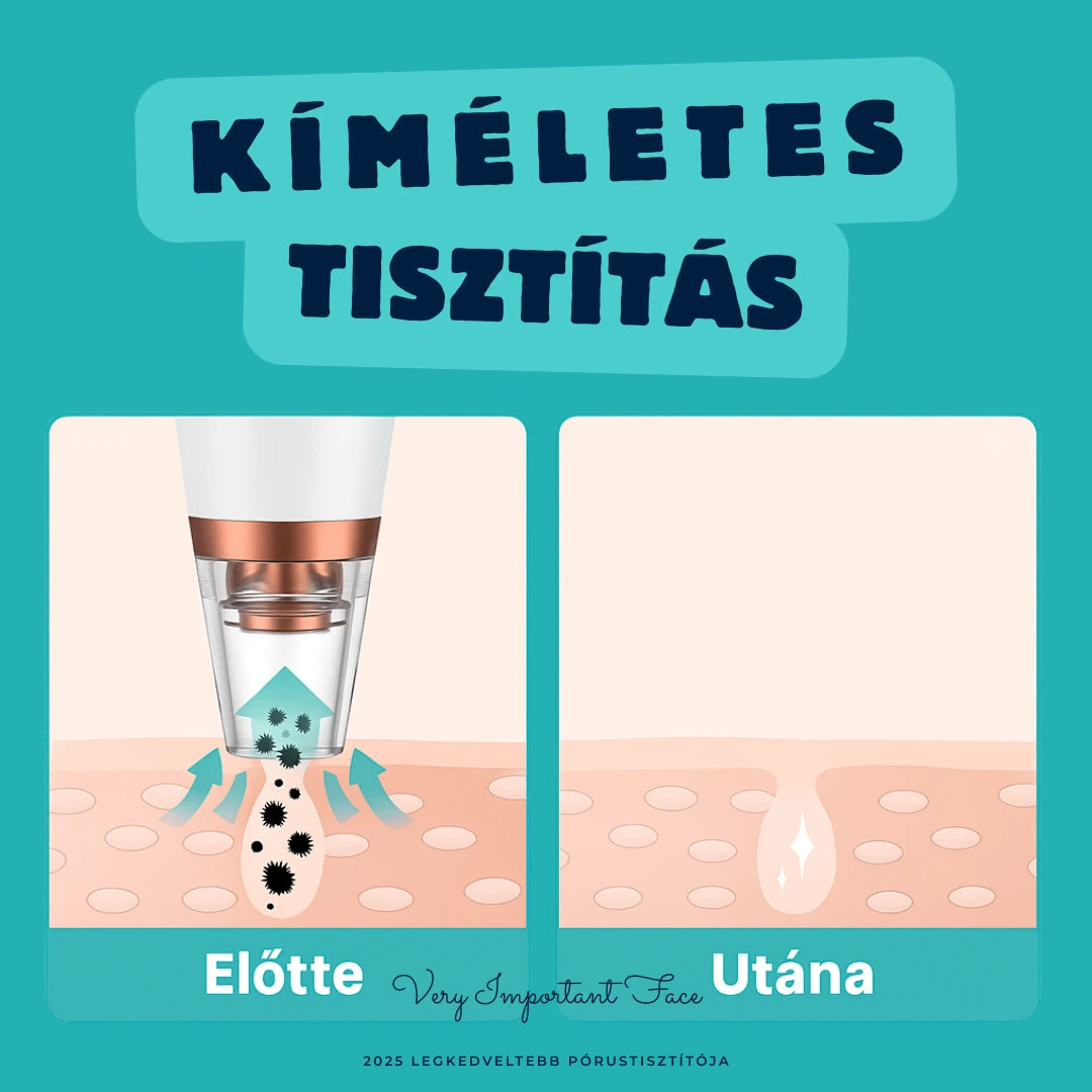 VIF™ DermaPure-vákuumos pórustisztító