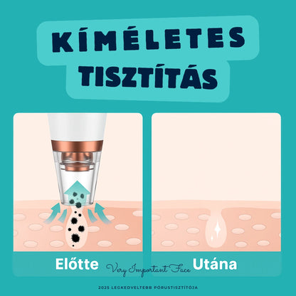 VIF™ DermaPure-vákuumos pórustisztító