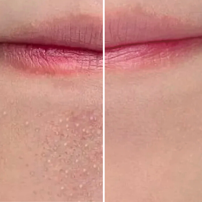 VIF DermaPure vákuumos pórustisztító – otthoni arctisztításhoz