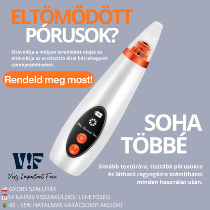 VIF DermaPure vákuumos pórustisztító – otthoni arctisztításhoz